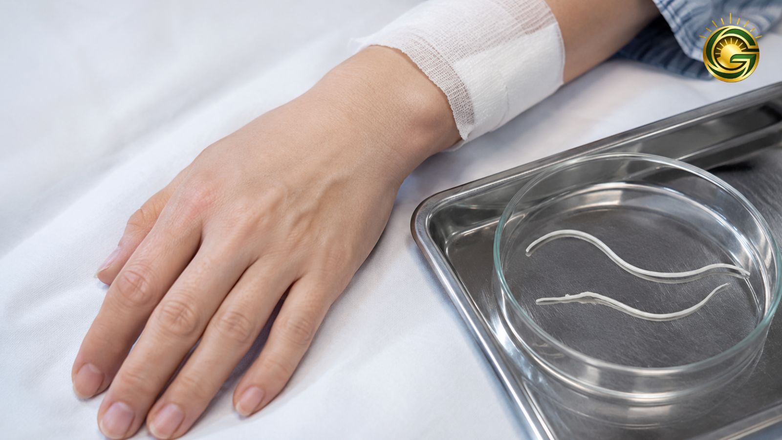 Medical setup showing a bandaged hand of a woman after surgery and a petri dish with parasite worms in human body.
